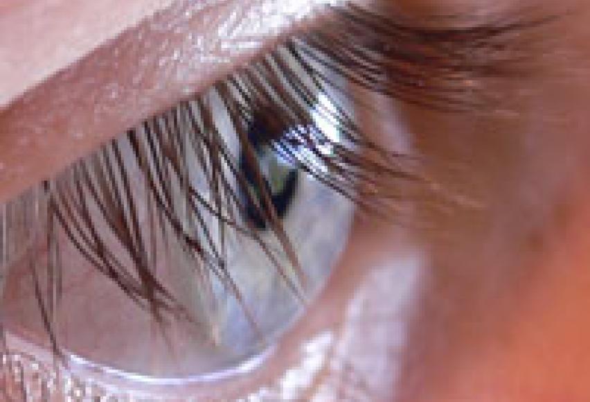 Eyelashes & Trichotillomania - Eyelash Pulling Compulsion | TrichStop.com